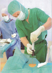 Comminuted Break - Stem Cell Therapy
