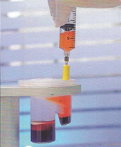 Comminuted Break - Stem Cell Therapy