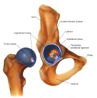 Hip Replacement - Alternative 3 Hip Replacement - Alternative 3