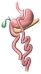 Gastric Bypass Illustrations